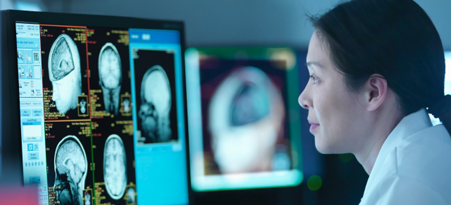 Una profesional médica observa las imágenes cerebrales de un paciente en un monitor de gran tamaño.